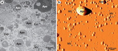 Different subsets of extracellular vesicles